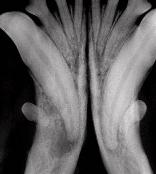 dental x-ray