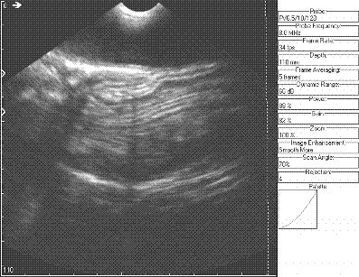 ultrasound